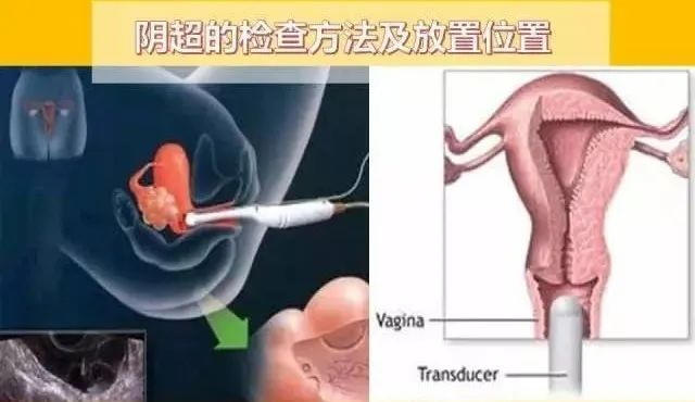 1703492960906531.png 图片 10.png